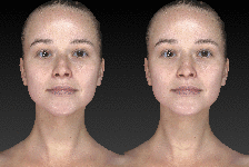 Nose_and_Chin_Combo_-_Animation_-_web_rd256